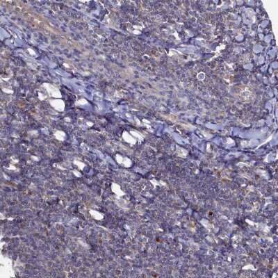 Immunohistochemistry-Paraffin: Thymidine Kinase 2 Antibody [NBP1-92505]