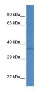 Western Blot: Thymidine Kinase 2 Antibody [NBP1-79890]