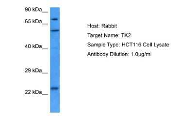 Western Blot: Thymidine Kinase 2 Antibody [NBP2-85914]