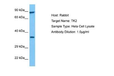 Western Blot: Thymidine Kinase 2 Antibody [NBP2-85915]