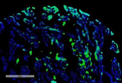 Immunohistochemistry: Thymidine glycol Antibody (B29) [NBP3-11041]