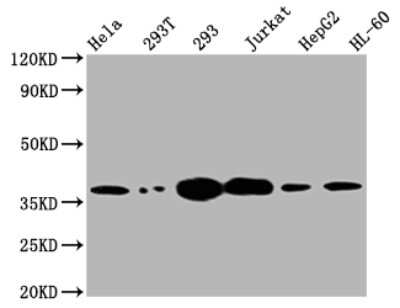 Western Blot: Thymidylate Synthase Antibody (2B2) [NBP3-15154]