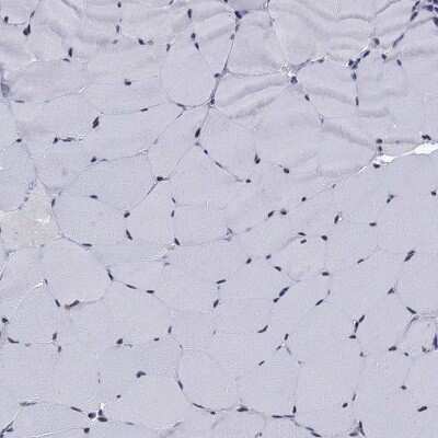 Immunohistochemistry-Paraffin: Thymidylate Synthase Antibody [NBP3-17004]