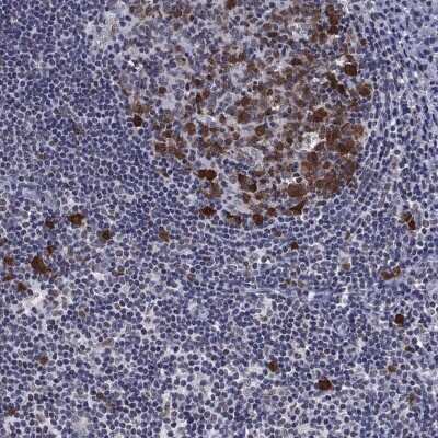 Immunohistochemistry-Paraffin: Thymidylate Synthase Antibody [NBP3-17004]