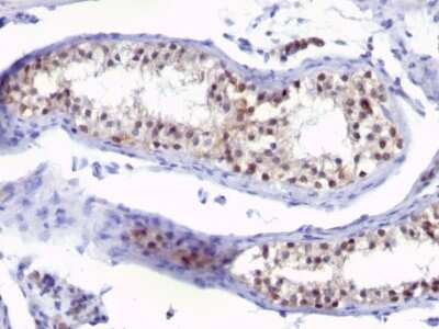 Immunohistochemistry-Paraffin: Thymidylate Synthase Antibody (SPM453) - Azide and BSA Free [NBP2-34441]