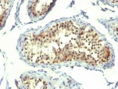 Immunohistochemistry-Paraffin: Thymidylate Synthase Antibody (TMS715) - Azide and BSA Free [NBP2-34725]