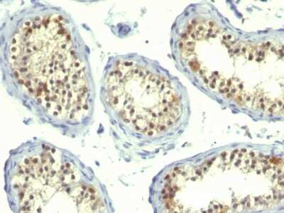 Immunohistochemistry-Paraffin: Thymidylate Synthase Antibody (TS106 + TMS715) - Azide and BSA Free [NBP2-34503]