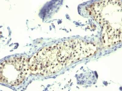 Immunohistochemistry-Paraffin: Thymidylate Synthase Antibody (TS106) - Azide and BSA Free [NBP2-34502]