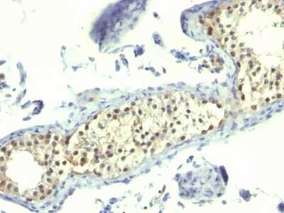 Immunohistochemistry-Paraffin: Thymidylate Synthase Antibody (TS106) [NBP2-34445]