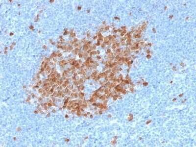 Immunohistochemistry-Paraffin: Thymidylate Synthase Antibody (TYMS/1884) - Azide and BSA Free [NBP3-08882]
