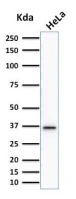 Western Blot: Thymidylate Synthase Antibody (TYMS/1884) [NBP3-07144]