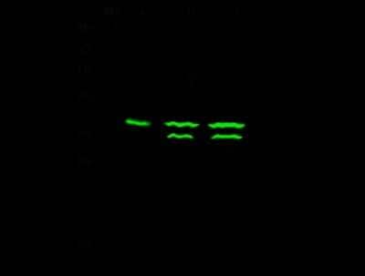 Western Blot: Thymidylate Synthase Antibody [NBP2-99086]