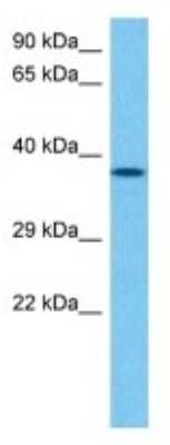 Western Blot: Thymidylate Synthase Antibody [NBP3-10109]