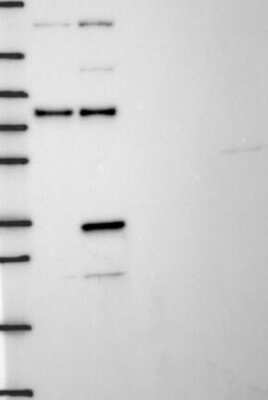 Western Blot: Thymidylate Synthase Antibody [NBP3-17004]