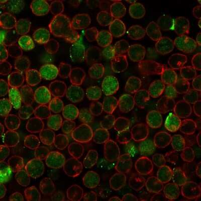 Immunocytochemistry/ Immunofluorescence: Thymidylate Synthase Antibody (rTYMS/1884) - Azide and BSA Free [NBP3-08887]