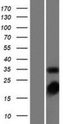 Western Blot: Thymidylate Synthase Overexpression Lysate [NBP2-08333]