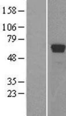 Western Blot: TDG Overexpression Lysate [NBL1-16797]