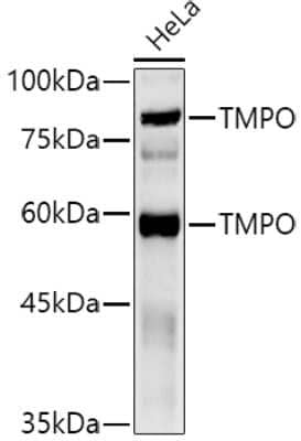 Western Blot: Thymopoietin/LAP2 AntibodyAzide and BSA Free [NBP3-03478]