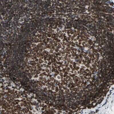 Immunohistochemistry-Paraffin: Thymopoietin/LAP2 Antibody [NBP1-87822]