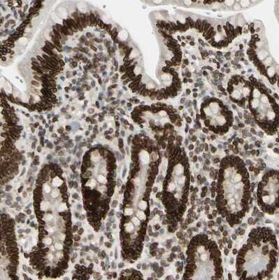 Immunohistochemistry-Paraffin: Thymopoietin/LAP2 Antibody [NBP1-87822]