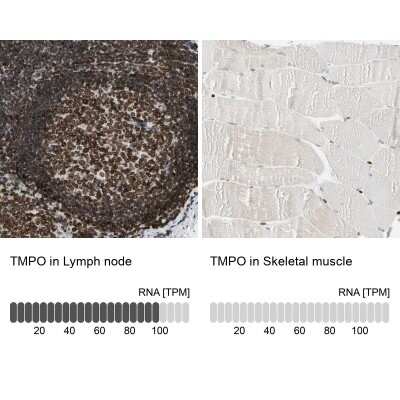 Immunohistochemistry-Paraffin: Thymopoietin/LAP2 Antibody [NBP1-87822]