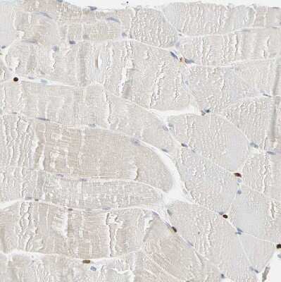 Immunohistochemistry-Paraffin: Thymopoietin/LAP2 Antibody [NBP1-87822]