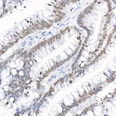 Immunohistochemistry-Paraffin: Thymopoietin/LAP2 Antibody - Azide and BSA Free [NBP3-03478]