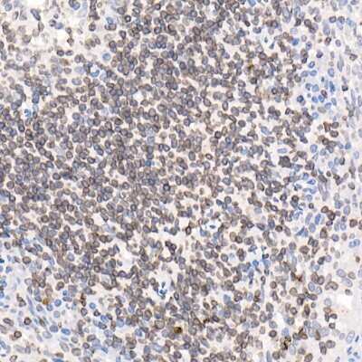 Immunohistochemistry-Paraffin: Thymopoietin/LAP2 Antibody - Azide and BSA Free [NBP3-03478]