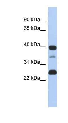 Western Blot: Thymopoietin/LAP2 Antibody [NBP1-59402]