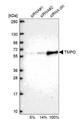Western Blot: Thymopoietin/LAP2 Antibody [NBP1-87822]