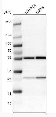 Western Blot: Thymopoietin/LAP2 Antibody [NBP1-87822]