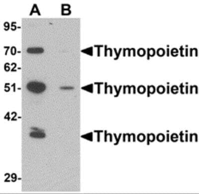 Western Blot: Thymopoietin/LAP2 AntibodyBSA Free [NBP2-81736]