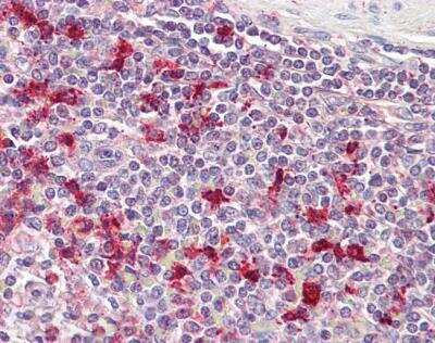 Immunohistochemistry-Paraffin: Thymosin alpha 1 Antibody [NBP1-36979]