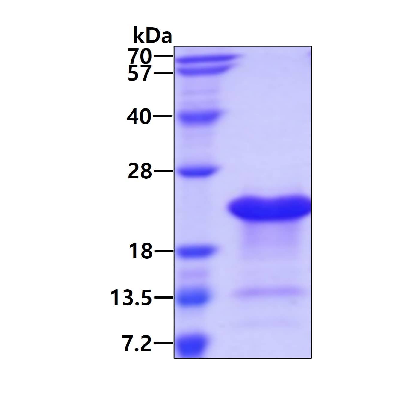 SDS-PAGE: Recombinant Human Thymosin alpha 1 His Protein [NBP2-23386]