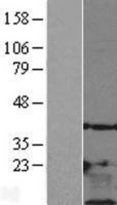 Western Blot: Thymosin beta 10 Overexpression Lysate [NBL1-17127]