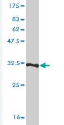 Western Blot: Thymosin beta 4 Antibody (4H7) [H00007114-M03-100ug]