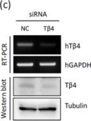 Western Blot: Thymosin beta 4 Antibody [H00007114-B01P]