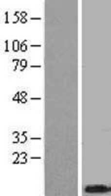 Western Blot: Thymosin beta 4 Overexpression Lysate [NBL1-17128]