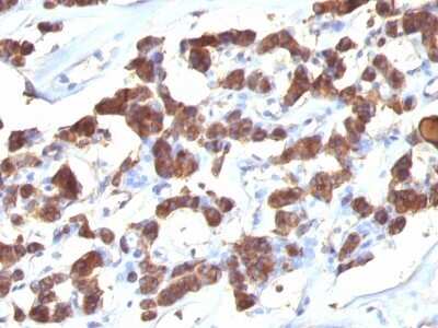 Immunohistochemistry-Paraffin: Thyroglobulin Antibody (2H11 + 6E1) - IHC-Prediluted [NBP2-45121]