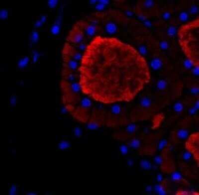 Immunohistochemistry-Paraffin: Thyroglobulin Antibody (2H11 + 6E1) - IHC-Prediluted [NBP2-45121]