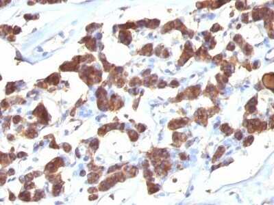 Immunohistochemistry-Paraffin: Thyroglobulin Antibody (2H11 + 6E1) [NBP2-34294]