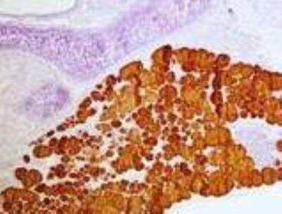 Immunohistochemistry-Paraffin: Thyroglobulin Antibody (2H11 + 6E1) [NBP2-34294]