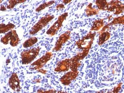 Immunohistochemistry-Paraffin: Thyroglobulin Antibody (2H11) - Azide and BSA Free [NBP2-33070]