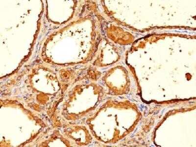 Immunohistochemistry-Paraffin: Thyroglobulin Antibody (6E1) - Azide and BSA Free [NBP2-33096]