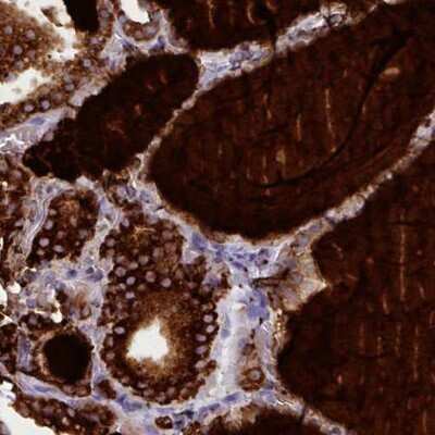 Immunohistochemistry-Paraffin: Thyroglobulin Antibody (CL0164) [NBP2-14784]