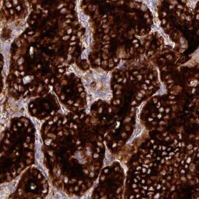 Immunohistochemistry-Paraffin: Thyroglobulin Antibody (CL0164) [NBP2-14784]