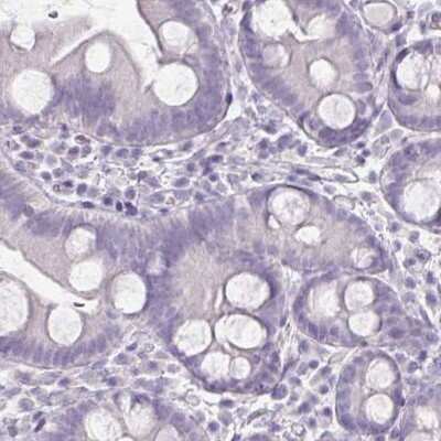 Immunohistochemistry-Paraffin: Thyroglobulin Antibody (CL0164) [NBP2-14784]