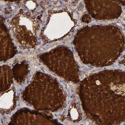 Immunohistochemistry: Thyroglobulin Antibody [NBP1-90200]