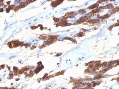 Immunohistochemistry-Paraffin: Thyroglobulin Antibody (SPM221) - Azide and BSA Free [NBP2-34748]