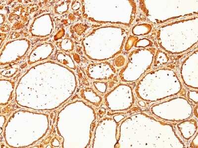 Immunohistochemistry-Paraffin: Thyroglobulin Antibody (SPM517) - IHC-Prediluted [NBP2-45120]